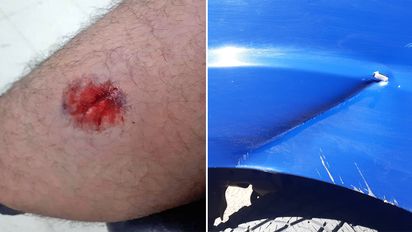 Mordió a un policía, dañó un móvil con un hacha y debió concurrir el GERS para detenerlo