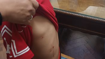 Violencia escolar: un estudiante fue agredido por un compañero en el Nacional y debieron asistirlo Violencia escolar: un estudiante fue agredido por un compañero en el Nacional y debieron asistirlo