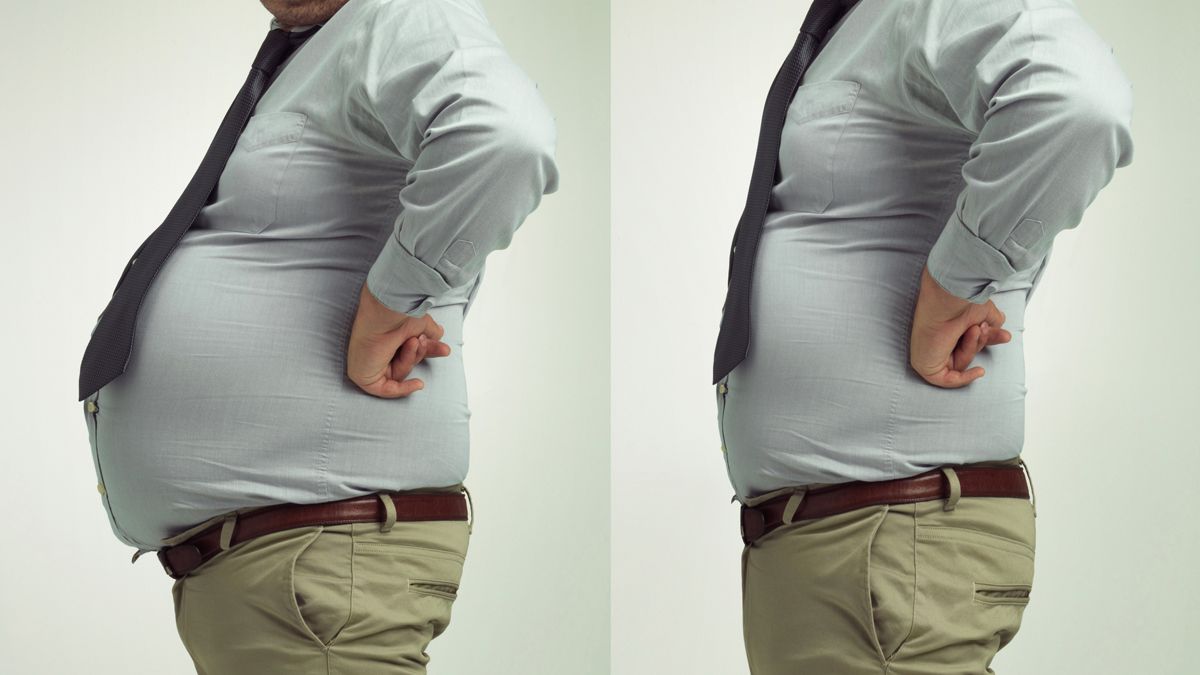 Está demostrado científicamente que la cirugía de la obesidad  y metabólica tiene muy buenos resultados a largo plazo.