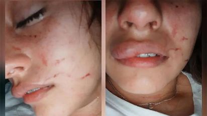 Cabrera: una joven denunció agresión policial tras un procedimiento en un boliche