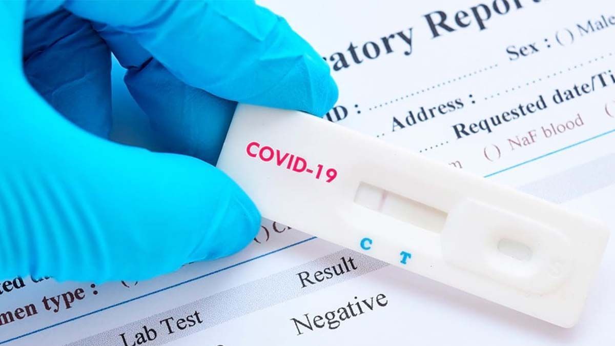 La Anmat aprobó cuatro autotest para detectar el coronavirus.