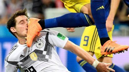 Se confirmó la fractura nasal de Sebastian Rudy