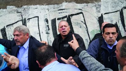 Piden investigar la agresión a Berni y denuncian que pudo ser un