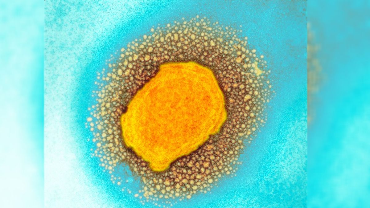 El virus de la viruela del simio (que se muestra aquí en una micrografíaelectrónica de transmisión en color) está estrechamente relacionado con elvirus de la viruela.