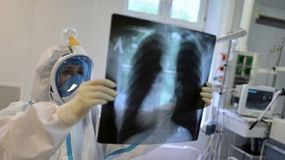 Estados Unidos prueba con éxito un cóctel de fármacos