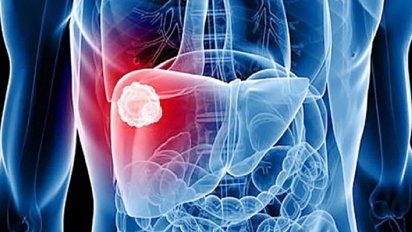 Más de la mitad de las personas que tienen hepatitis C no lo saben