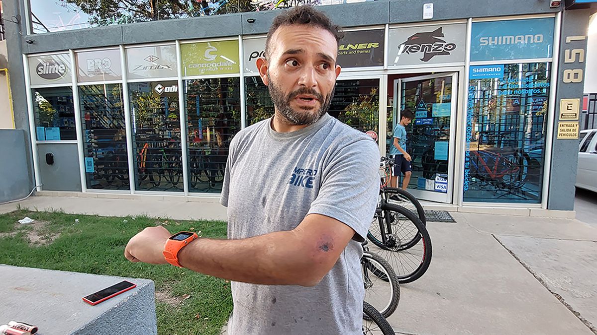 Gallardo sufrió algunas escoriaciones al enfrentarse con el joven delincuente. Foto: Matías Tambone.
