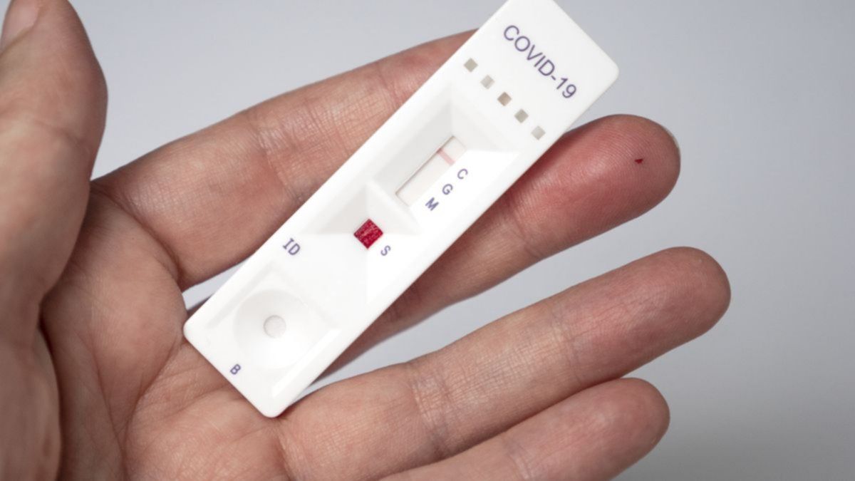 La Anmat aprobó cuatro autotest para detectar el coronavirus.