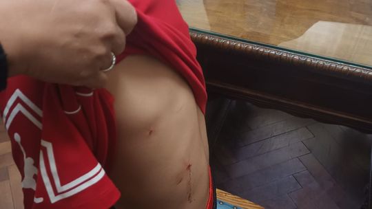 Violencia escolar: un estudiante fue agredido por un compañero en el Nacional y debieron asistirlo