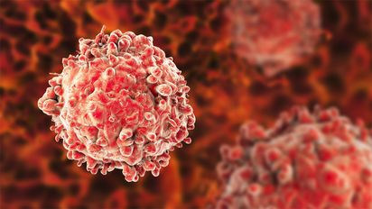 ¿Por qué hay pacientes con leucemia que no necesitan tratamiento?