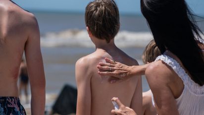 Recomendaciones para evitar efectos dañinos del sol en la piel