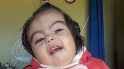 Pedido de ayuda de una familia de Canals para tratar a su beba con  hidrocefalia