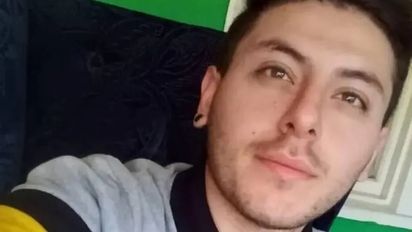 Murió el joven cordobés que contrajo viruela del mono en México