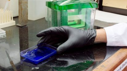 Identifican falla en proteína del colesterol 