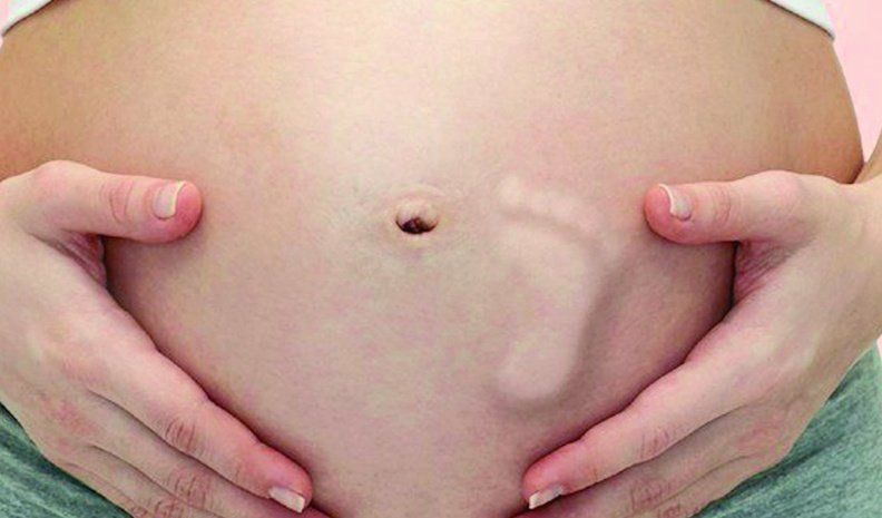 Especialistas explicaron que si no hay ninguna desviación en la atención “no hay por qué” intervenir en el parto.