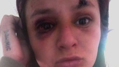 Del Campillo: fue brutalmente golpeada por un hombre y abandonó el pueblo por temor
